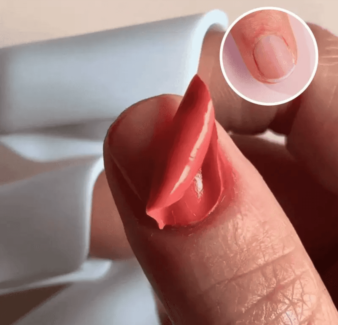 Peel-off removal